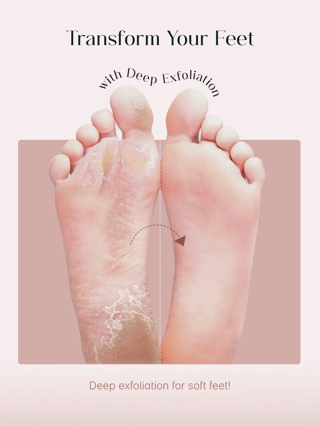 seoulskin glycolic acid foot peeling mask