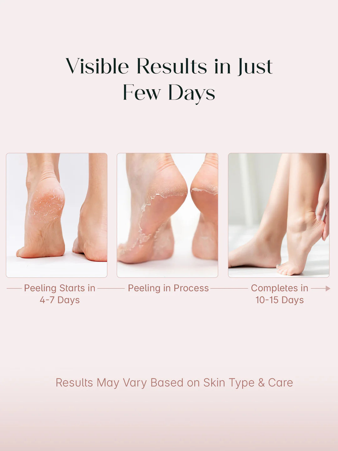 seoulskin glycolic acid foot peeling mask